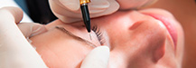 Hair Removal